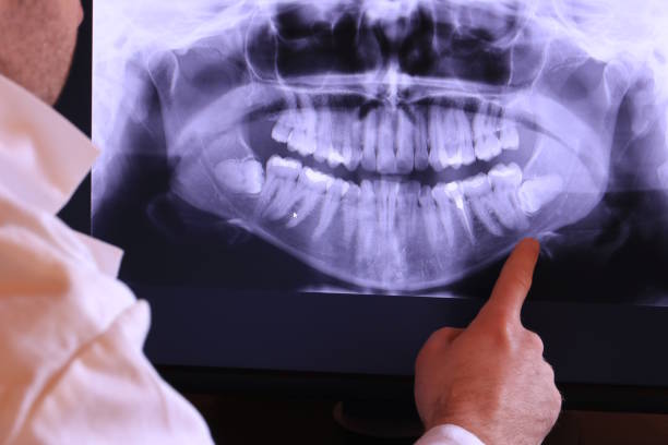 Best Tooth Pain Emergency Relief  in Hamilton Square, NJ