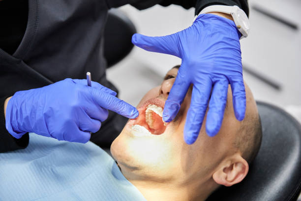 Best Dentist for Tooth Abscess  in Hamilton Square, NJ